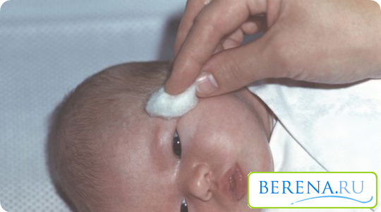 Некоторые новорожденные страдают от непроходимости слезного канала, иногда это состояние проходит через 2 недели после рождения