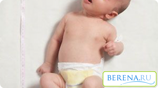 Кривошея у новорожденных - заболевание, характеризующееся изменением мягких тканей