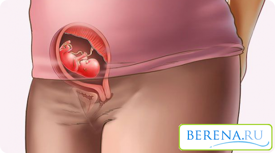 Иногда плацента закрепляется так низко, что перекрывает выход из полости матки, в таком случае женщине будут делать кесарево сечение
