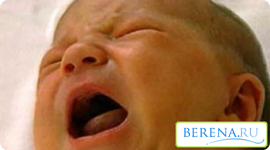 Физиологическая желтуха новорожденных появляется на 2й день после родов, а недоношенные дети начинают страдать ею несколько быстрее и интенсивнее