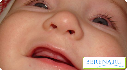 Срок прорезывания первых и последующих зубов строго индивидуален у каждого ребенка