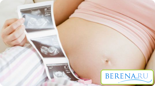 УЗИ рекомендуется делать три раза, но при желании беременная может отказаться от этого обследования