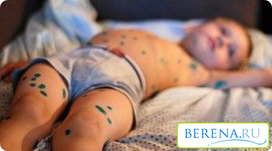 Во время лечения больному ребенку необходим постельный режим, соблюдение гигиены и витаминная диета