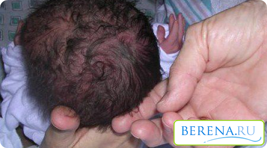 Специалисты категорически отрицают возможность мытья головы малышу шампунем, которым пользуетесь вы сами. Содержание и примеси шампуней для взрослых может вызвать у ребенка аллергию.